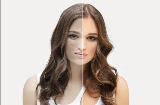 🌞انترفارما | تبييض البشرة في الصيف